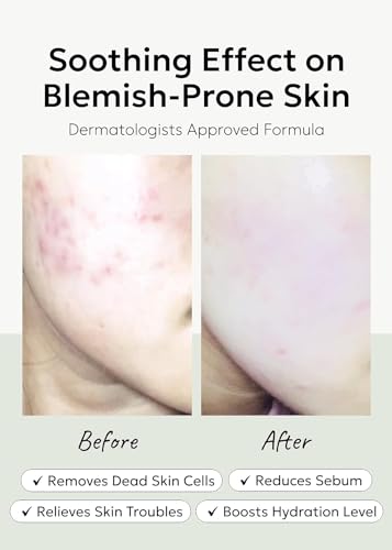 celimax Ji.Woo.Gae Heartleaf BHA Peeling Pad Double Edition(60pads*2) + ONE STEP Body Brightening Pad 110ml (60 pads) Bundle