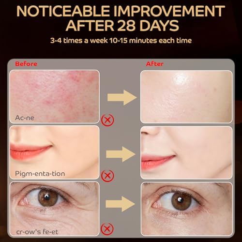Red Light Therapy for Face, LED Red Light Therapy Mask 660nm & 850nm Wavelength for Home Use