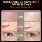 Red Light Therapy for Face, LED Red Light Therapy Mask 660nm & 850nm Wavelength for Home Use