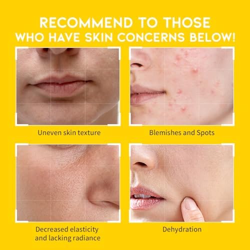 Boosting Toner Pads for Face Oily Skin Korean, #OOTD Vitamin C Niacinamide Heartleaf Hydrating Calming Redness, Vitamin C Toner Pad 70Pads 4.05oz 120ml