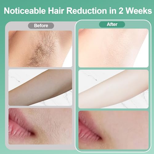 Laser Hair Removal, IPL Laser Hair Removal for Women and Men, 32°F Sapphire Ice Cooling System, Laser Hair Removal Device At Home, Almost Permanent Painless Whole Body Hair Removal