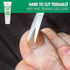 Toenail Soft Temporary Nail Softening Cream for Thick, Hard Toenails with Aloe 1 Oz