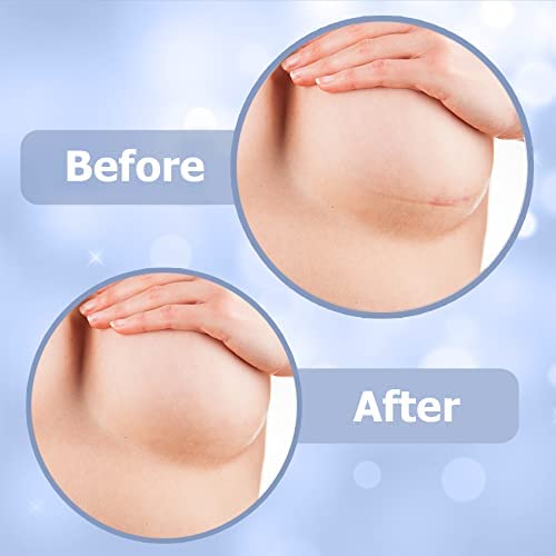 Breast Surgery Recovery Essentials - Silicone Scar Sheets for Comfort and Healing - Ideal for Post-Op Wear