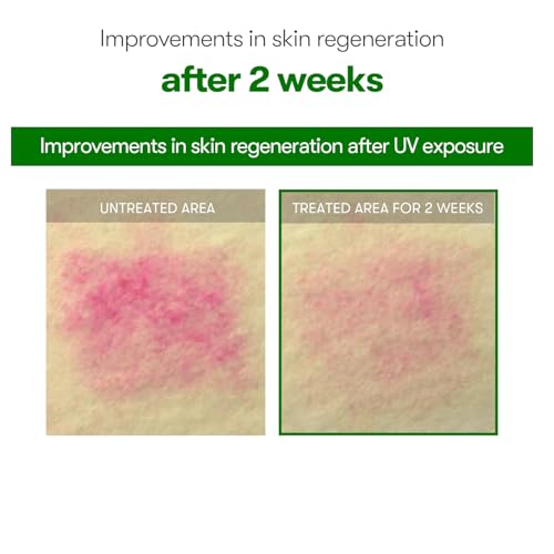 VT COSMETICS CICA Reedle Shot 700, Spicule Microneedling Serum for Pore Care&Exfoliation, Exosome&Centella Asiatica for Glass Skin, Acne&Blemish Care, Korean Liquid Skin Booster (1 Fl Oz / 30ml)