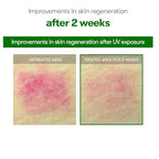 VT COSMETICS CICA Reedle Shot 700, Spicule Microneedling Serum for Pore Care&Exfoliation, Exosome&Centella Asiatica for Glass Skin, Acne&Blemish Care, Korean Liquid Skin Booster (1 Fl Oz / 30ml)