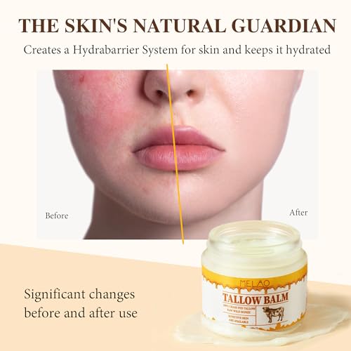 Pulchra Beef Tallow and Honey Balm for Skin: Premium Tallow Honey Skin Balm - Grass-Fed Beef Tallow & Raw Wild Honey Blend - All-Natural Moisturizer for Face & Body, Tallow Balm for Skin Hydration