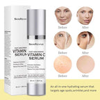 SkinRevive Super Vitamin C Serum for Women over 70, Vitamin C Serum for Mature Skin Face Hydrates, Firms, Lifts, Targets Age Marks, Wrinkles and Smoothes Skin Texture 1.69 fl oz