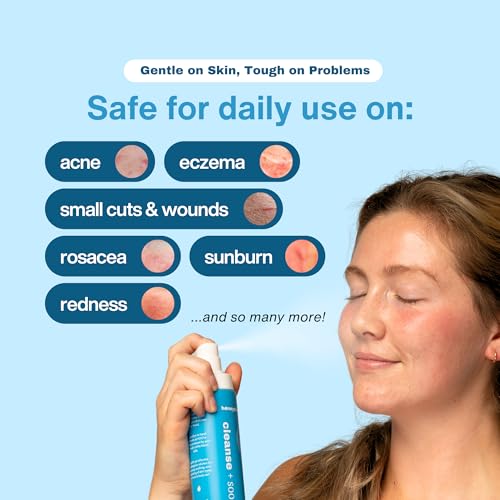 Hypochlorous Acid Spray – HOCl Face & Skin Mist for Acne, Eczema & Irritation – Multi-Purpose Skin Repair – Eyelid Cleanser, Post-Workout, Post-Procedure, Scalp & Sensitive Skin – 6.8 oz