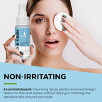 Essentially Based Eyelid Cleanser Kit - 2 oz Eyelids and Eyelash Cleaner - Hypochlorous Acid Spray Solution - Eye Wash Solution with 30 Application Pads - Made in USA