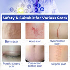 Silicone Scar Sheets - Gel Silicone Scar Tape (1.6” x 120”), Invisible Medical Grade Scar Silicone Strips, Transparent Removal Scar Patches for Keloids, Burn, C-Section, Acne