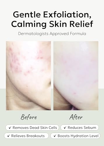 celimax Ji.Woo.Gae Heartleaf BHA Peeling Pad(60 pads) + ONE STEP Body Brightening Pad 110ml (60 pads) Bundle