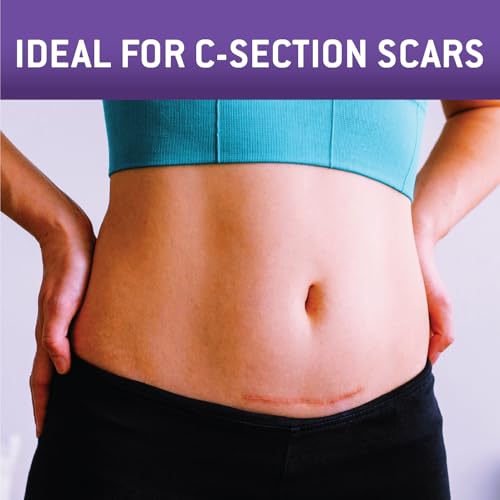 Care Science C Section Recovery Silicone Scar Sheets 1.5in x 7in 8ct | Reuseable Scar Sheets for Reducing the Appearance of C-Section, Keloid, and Acne Scars