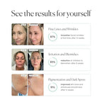 Qure LED Skin Care FDA Cleared LED Face Mask With 5 Different Modes - Red and Blue Light Therapy Face Mask In One Device with Customizable Settings, Treatments & Integrated Phone App for at Home Use