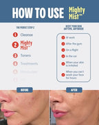 Mighty Mist Premium Hypochlorous Acid Spray for Acne, Eczema, Rosacea | Safe for All Skin Types | Safe for Sensitive Skin | Soothes Irritation and Redness