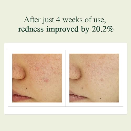 Pyunkang Yul [PKY] Calming Madecasoside Spot Cream 30ml I Madecassoside, Centella Asiatica Extract, Niacinamide, Panthenol Hyaluronic Acid