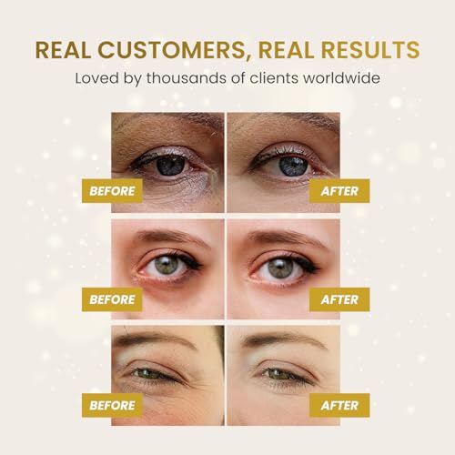 PLANTIFIQUE Gold Eye Patches for Puffy Eyes | 20 Pairs | Valentines Day Gifts Under Eye Masks for Dark Circles | Puffiness Eye Gels | Eye Mask Skincare