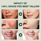 Beef Tallow for Skin, Beef Tallow and Honey Balm for Face and Body, Unscented Face Moisturizer, Deep Hydration & Sensitive Skin Care, 4.23oz
