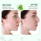 Centella Serum, Face Hydrating Fermented Centella Asiatica Serum, Soothing, Barrier Repair, Firming, Revitalize Glowing Centella Ampoule Facial Moisturizer with Ceramide NP, for All Skin (50ml)