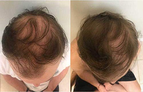 Zenagen Revolve Thickening Hair Loss Treatment for Men