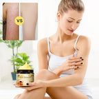 Bee Venom Cream, 2024 New Professional Bee Venom Moisturizing Cream,Bee Venom Moisturizing Gel, Natural Bee Venom Repair Cream, for All Skin Types (2pcs)