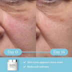 ELEMIS Dynamic Resurfacing Facial Pads, Gentle Textured Treatment Facial Exfoliating Pads