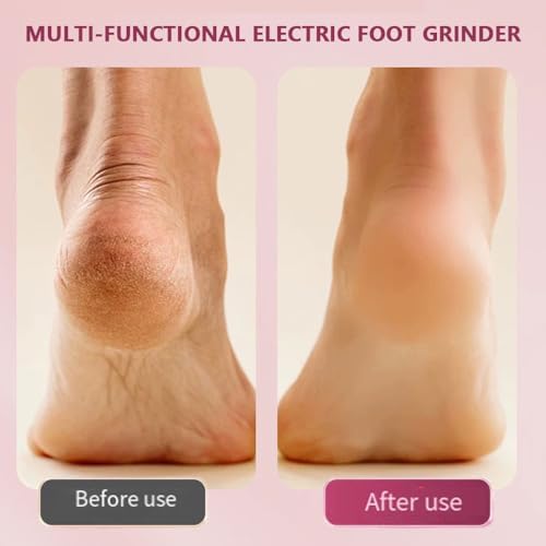 2in1 New Electric Foot Callus Remover & Nail Drill,for Callus Remover for Feet,Nail Art | Callus Remover for Feet with 20Pcs Disc Sandpaper and 10Pcs Barrel Sandpaper