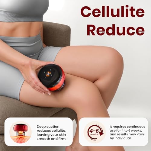 5-in-1 Smart Dynamic Cupping Therapy Set with 20 Level Temperature and Suction, Cupping Kit for Massage Therapy, Electric Cupping Device with Red Light for Back Muscle Soreness (Red)