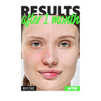 NOSCA9 Trouble Serum S - Rapid Hydrating Calming Serum with 5-Layer Ceramide Complex &Fresh Centella Asiatica, Advanced Barrier Repair for Sensitive & Acne-Prone Skin