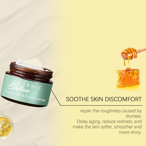Organic Grass Fed Whipped Tallow Cream with Castor Oil & Frankincense Oil, All-Natural Moisturizer, Hydrating Beef Tallow Moisturizer Cream and Manuka Honey Balm for Skin (1)
