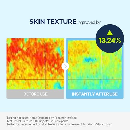 Torriden Dive in Toner 300ml (10.14 fl. oz.) | pH Balancing Facial Toning Water for Dry Skin | Hyaluronic Acid, Panthenol, Allantoin