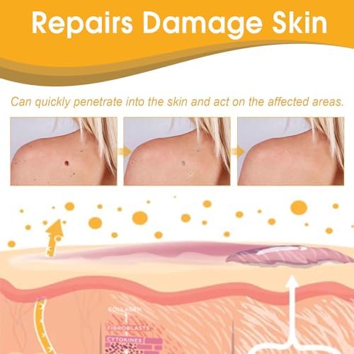 Tag Recede Bee Venom,2025 Tag Recede, TagRecede,Tag Recede Bee Venom Spray for All Skin Types(3PCS)