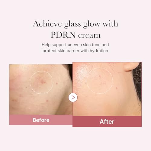 medicube PDRN Pink Moisturizing Cream, Pink Soothing Cream, Niacinamide, Hydrating & Moisturizing & Firming, Uneven Skin Tone, Korean Skincare (1.69 Fl Oz (Pack of 1), Rose PDRN (Vegan))