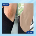 Skin Whitening Cream, Intimate Bleaching Cream for Women, Skin Lightening Cream for Dark Spots, Private Parts, Underarms, Elbows, Armpits, Knees, Inner Thighs