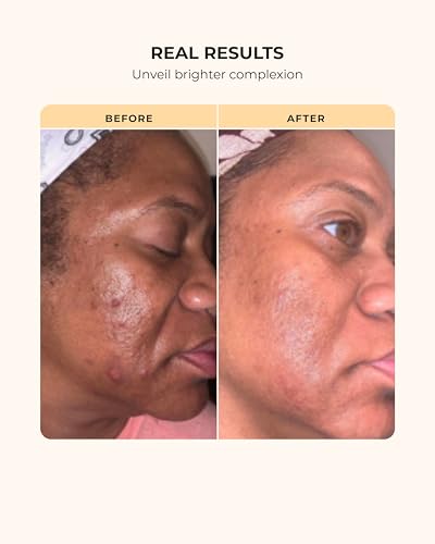 Buttah Skin by Dorion Renaud Complete Melanin-Rich Skin Care Kit | Shea Butter, Vitamin C Serum, Facial Cleanser | Organic & Natural | Black-Owned