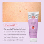 First Aid Beauty - KP Bump Eraser Body Scrub with 10% AHA, Keratosis Pilaris Exfoliater with Glycolic and Lactic acids, Helps Reduce Chicken Skin Bumps, Safe for Sensitive Skin, Strawberry Scent, 2 oz