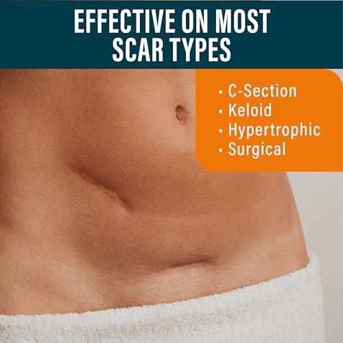 NUVADERMIS Silicone Scar Sheets – Extra Long Medical-Grade Scar Sheets for C-Section, Tummy Tuck, Keloid, and Surgical Scars – Reusable and Effective – Pack of 4 – Dark Tone