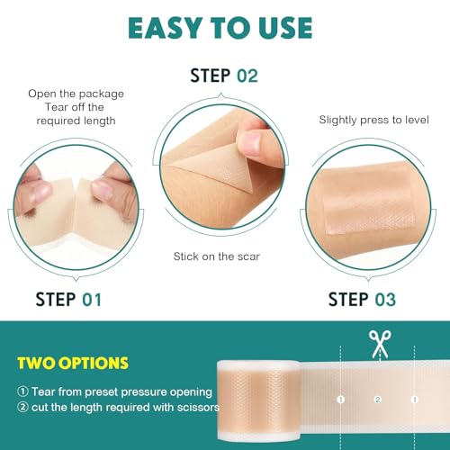 Silicone Scar Sheets, Silicone Scar Tape Strips(1.6”x 60” Roll-1.5M), Professional Away Sheets for Surgical Scars, Keloid, C-Section, Burn et