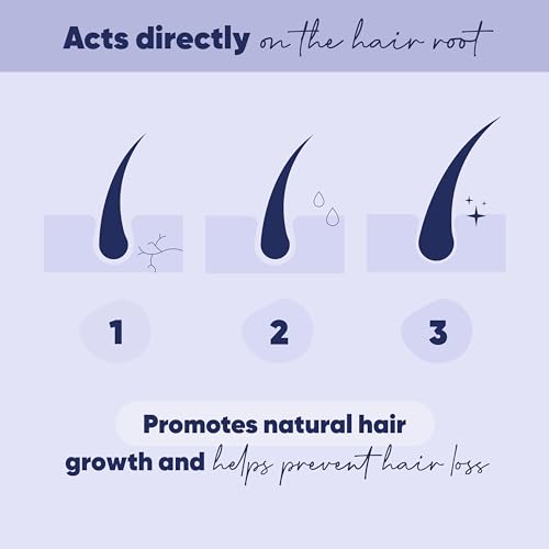 MOERIE Ultimate Hair Growth Serum for Natural Hair Regrowth & Thickening - Anti Thinning & Hair Loss Treatment for Women - Rapid Hair Growth Products - Scalp Oil Alternative - 1.69 fl oz / 50 ml