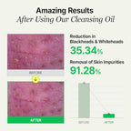LHA Deep Cleansing Oil, Makeup, Blackhead and Whitehead Remover, Korean Skin Care, Vegan, 6.93 Fl Oz