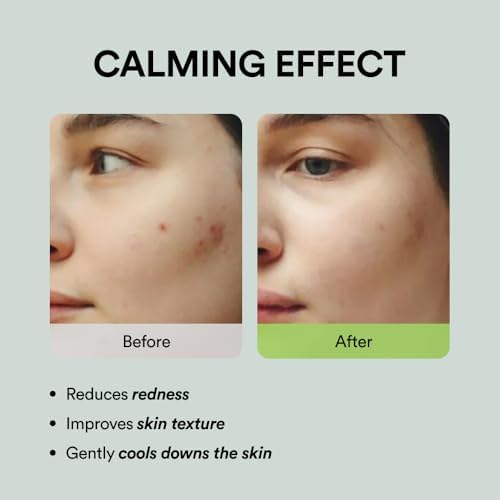 Abib Heartleaf Spot Pad Calming Touch 80pads 5.07 fl.oz. | Korean Acne Soothing Toner Pads for Face, Cleansing, Disposable, Exfoliant, Skin Care