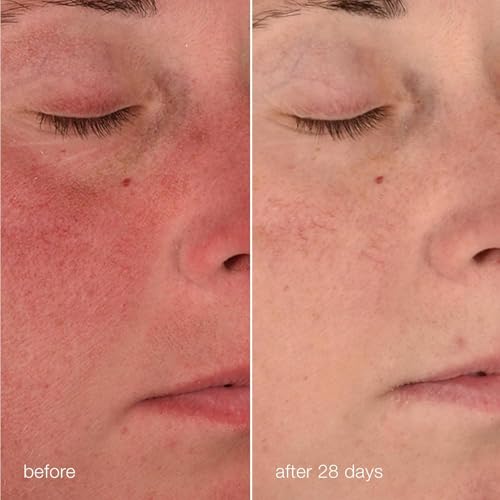 Dermalogica Stabilizing Repair Cream, Face Moisturizer for Sensitive Skin with Cica - Strengthens, Soothes, and Repairs Skin Barrier