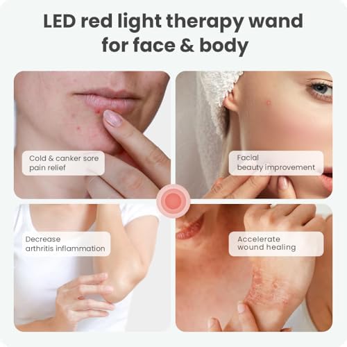 Red Light Therapy for Face, FSA HSA Eligible Cold Sore Treatment Red Light Therapy Wand, Rechargeable Clinical Grade Infrared Light Therapy, Ideal for Lips, Skin, Pain Relief, Fast Recovery