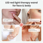 Red Light Therapy for Face, FSA HSA Eligible Cold Sore Treatment Red Light Therapy Wand, Rechargeable Clinical Grade Infrared Light Therapy, Ideal for Lips, Skin, Pain Relief, Fast Recovery