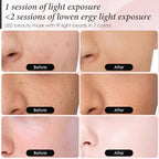 Red Light Therapy for Face, 7 Colors LED Face Mask Light Therapy At Home, Led Face Mask Light Therapy, White