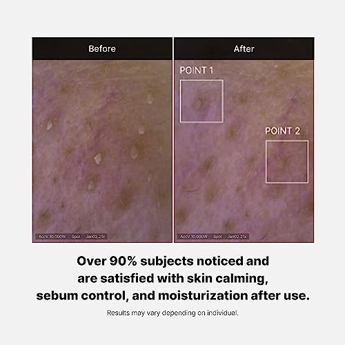 medicube Red Foam Cleanser - Deeply cleanses, remove impurities, control sebum, | Korean Skincare