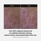 medicube Red Foam Cleanser - Deeply cleanses, remove impurities, control sebum, | Korean Skincare