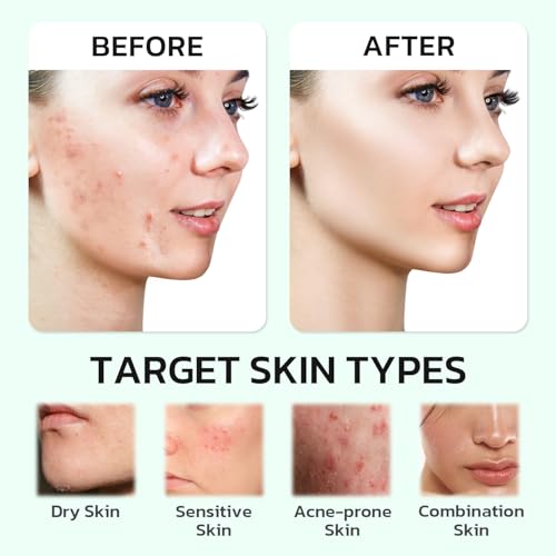 Centella Moisturizer Phytocin Cream Soothing Centella Asiatica Moisturizer Face Hydration Barrier Repair Calming PDRN Cream for Acne Prone, Sensitive Skin, Ceramide, B5, Salmon (30ml)