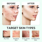 Centella Moisturizer Phytocin Cream Soothing Centella Asiatica Moisturizer Face Hydration Barrier Repair Calming PDRN Cream for Acne Prone, Sensitive Skin, Ceramide, B5, Salmon (30ml)
