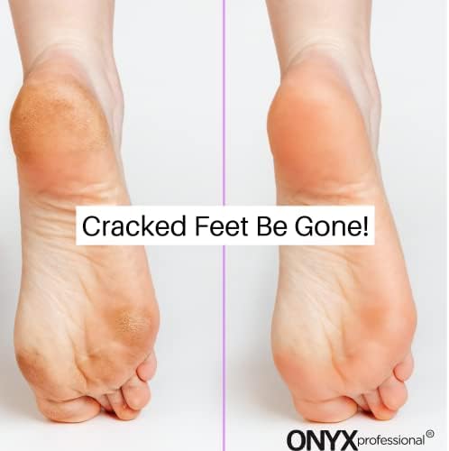 Onyx Professional Gel Moisturizing Socks, One Size Dry Feet Treatment for Women or Men, Hydrating Spa Socks for Dry Feet and Cracked Heel Repair, One Reusable Pair