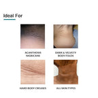 FIXDERMA Nigrifix Cream for Acanthosis Nigricans with Lactic Acid | Dermatologist Tested Retinol Cream | Useful for Dark Body Parts like Neck, Ankles, Armpits & Elbows –3.52 FlOz